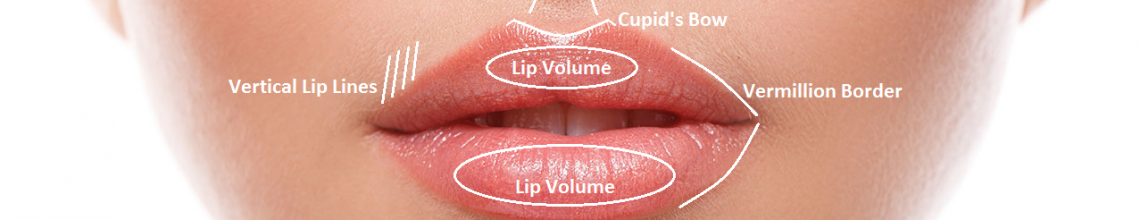 lip fillers pictures